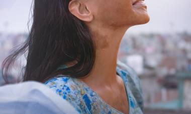 ஆசிட் வீச்சில் பாதிக்கப்பட்ட பெண்ணாக தீபிகா படுகோனே!!