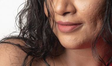 Actress #Sabbitaroi Hot & Bold Photoshoot Pics